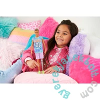 Mattel Barbie Fashionistas Fiú Barát baba - Lábprotézissel (DWK44-HJT11)